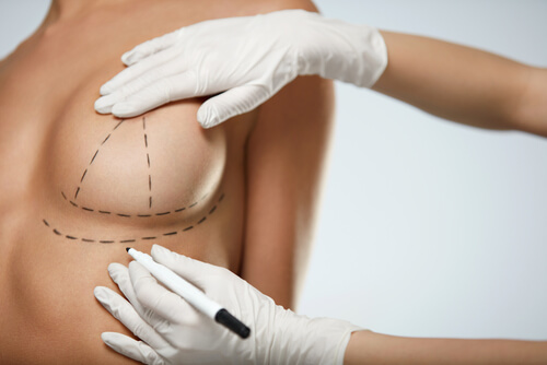 closeup hands in gloves drawing surgical lines on beautiful woman breasts-img-blog