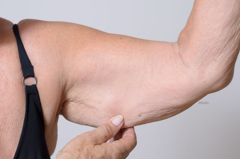 Woman holding up her arm and showing her sagging arm skin