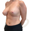 After Image