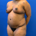 After Image