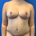 After Image